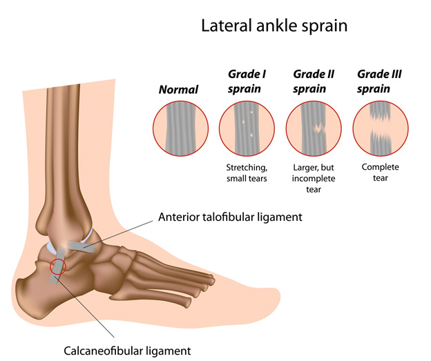 5 Most Common Injuries In Soccer. What You Need To Know