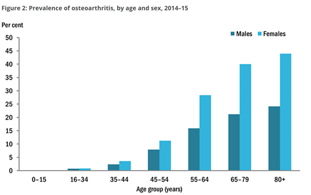 Osteoarthritis Exercises for Knee Pain